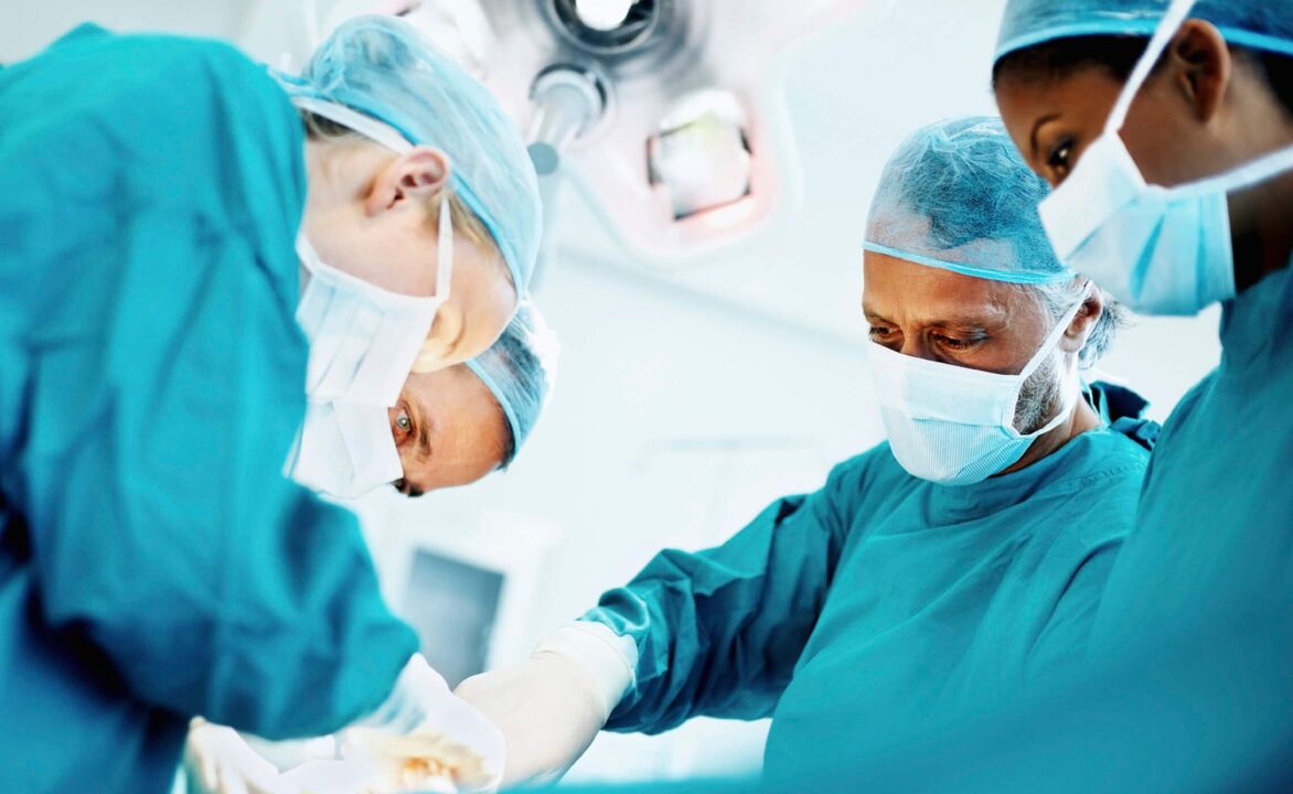 外科医生通过手术增大阴茎的过程